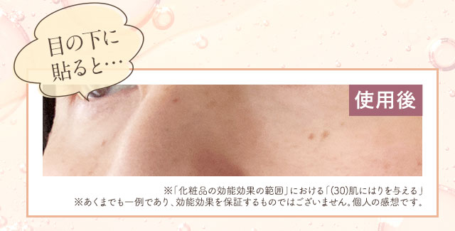 目の下に貼ると