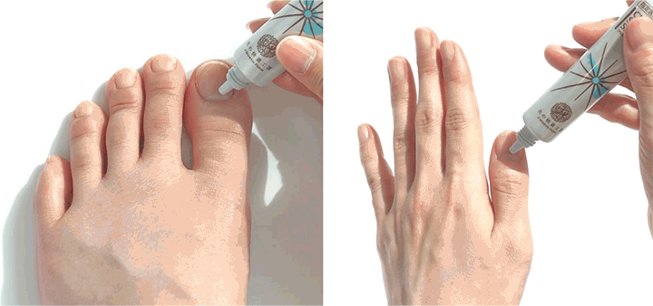 薬用クリアストロングショットアルファは手足の爪に塗り込むだけ。